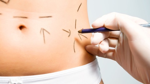 cirugia-estetica-opinion-pacientes